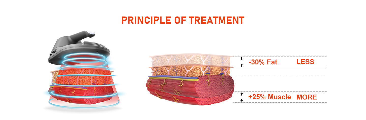 VIVID SCULPT - Four Treatment/Month